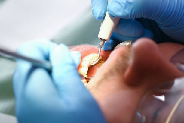 Best Emergency Dentist Near Me  in Mcconnelsville, OH