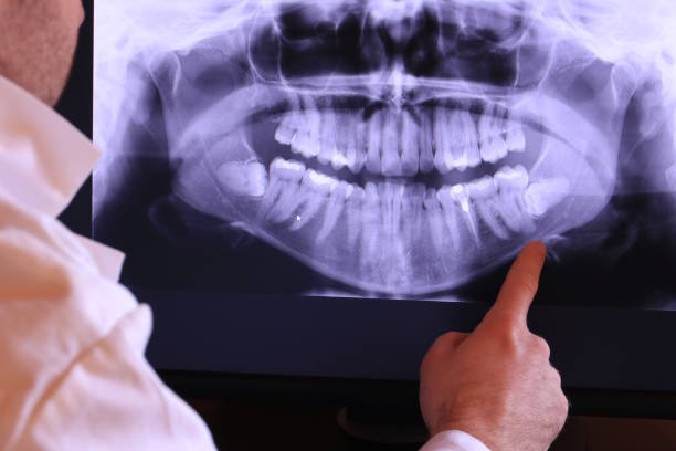 Best Teeth Whitening  in Mcconnelsville, OH