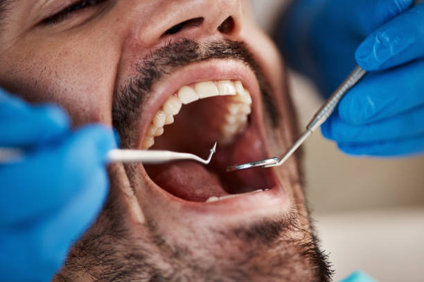 Best Tooth Infection Emergency Dentist  in Mcconnelsville, OH