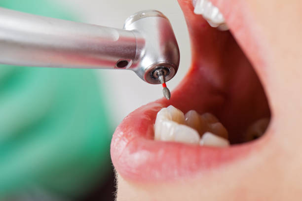 Best Emergency Gum Pain Relief  in Mcconnelsville, OH